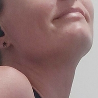 adorablegains Alaston
