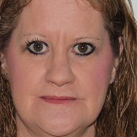 Andrea Lawrence Alaston