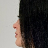 ann_mii Alaston