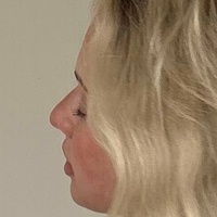 blondesnooki3 Alaston