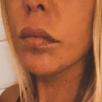 blondibomb Alaston