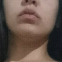brassa Alaston