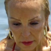 Carmen Lomana Alaston