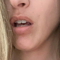 emma-skyeefree Alaston