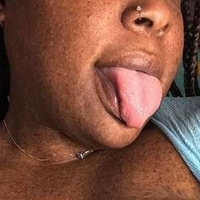 freckledfantasy5 Alaston