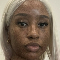 freckledn Alaston
