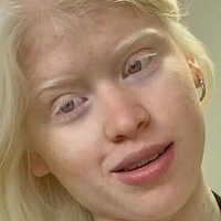 Guada Scarione Alaston