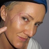 Keala Kennelly Alaston