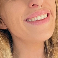lolokolivia Alaston
