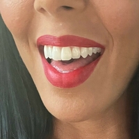 rachelstarrxxx Alaston