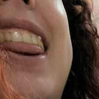 sam-dreamy-lips-vip Alaston