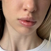 shellysecret Alaston