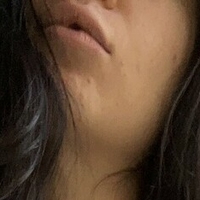 traversetina Alaston