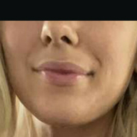 Wettmelons Alaston