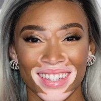 Winnie Harlow Alaston