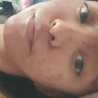 xsugarvulpesx Alaston
